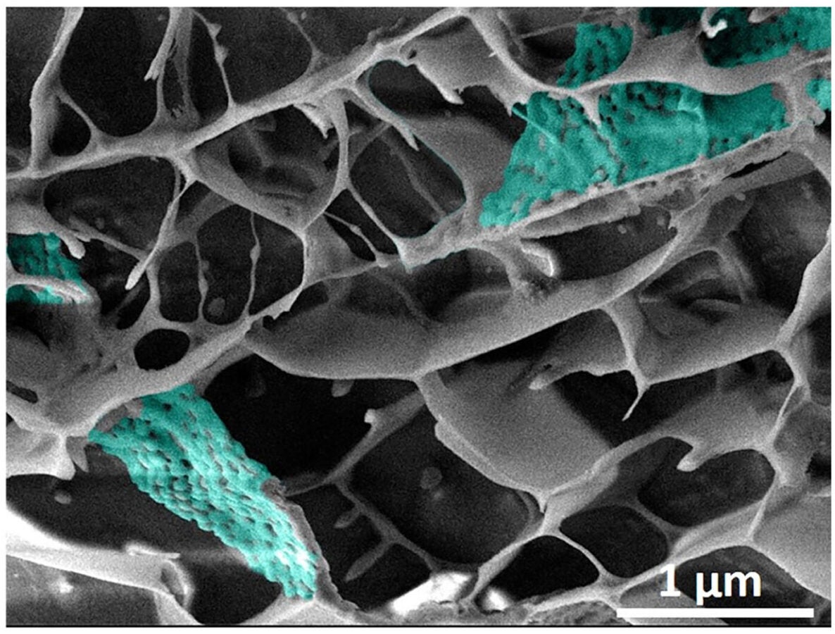 Scanning electron microscopy image highlighting the structural integration of BK-TriGs (false coloring) within the fibrin matrix, emphasizing the close association and distribution of the microgels within the fibrin architecture.