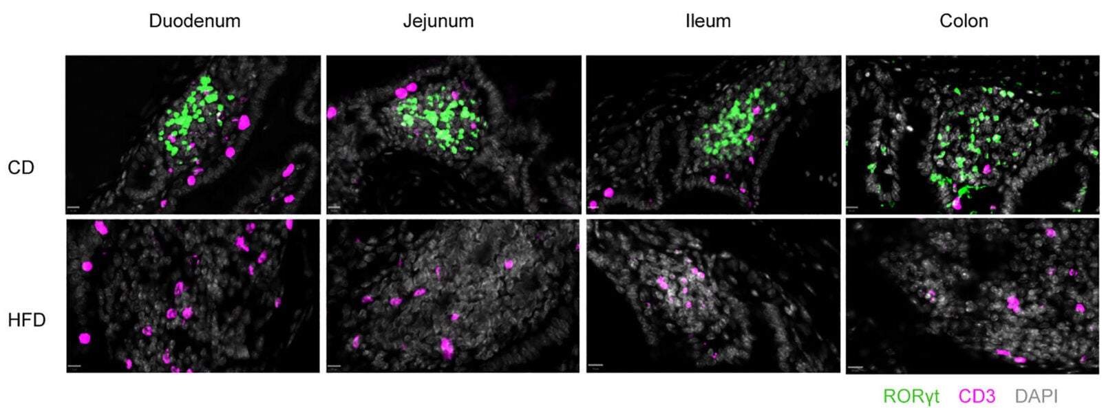 Representative immunofluorescence staining and quantification of ROR-γt+CD3− ILC3s (green), CD3+ T cells (pink), and ROR-γt+CD3+ Th17 (yellow) in the duodenum.