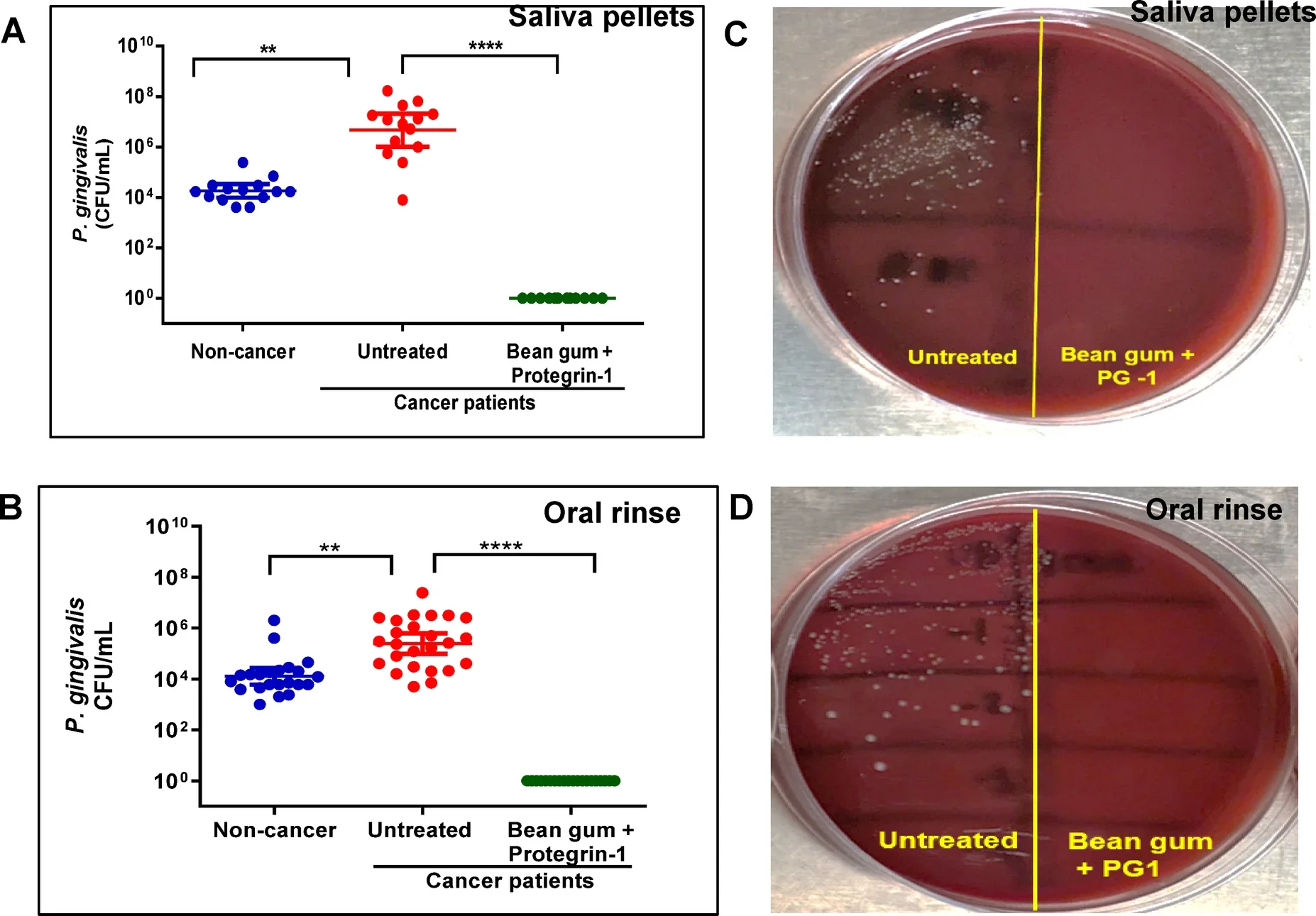 Effect of bean gum+PG1 on Pg in saliva and oral rinse samples of HNSCC patients.