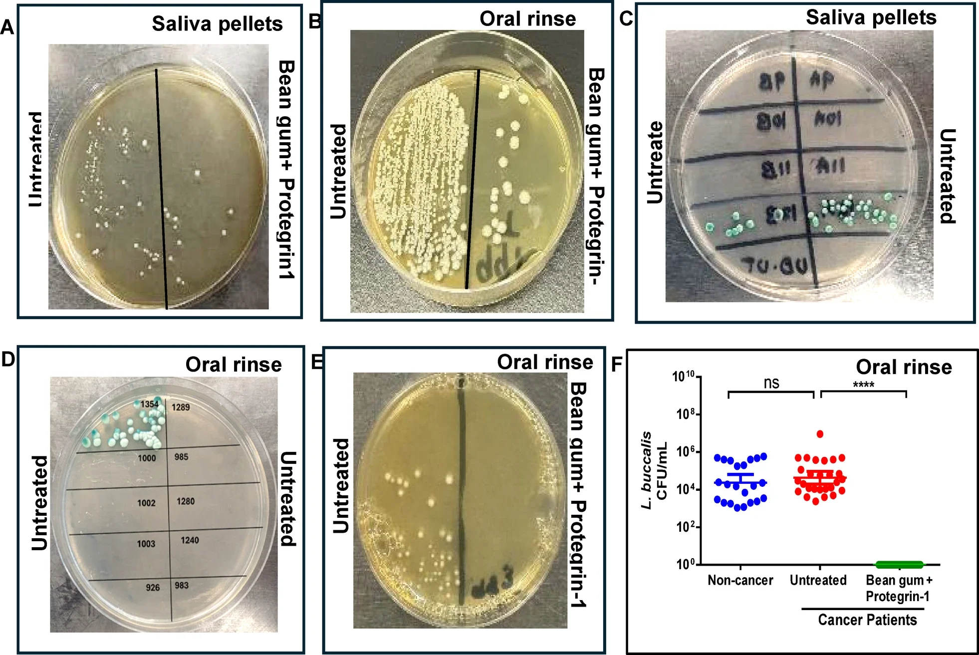 HNSCC associated microbes in saliva (n= 14 non-cancer; n = 16 cancer samples) and oral rinse (n=22 non cancer, n=30 cancer samples) of HNSCC patients and non-cancer cohort.