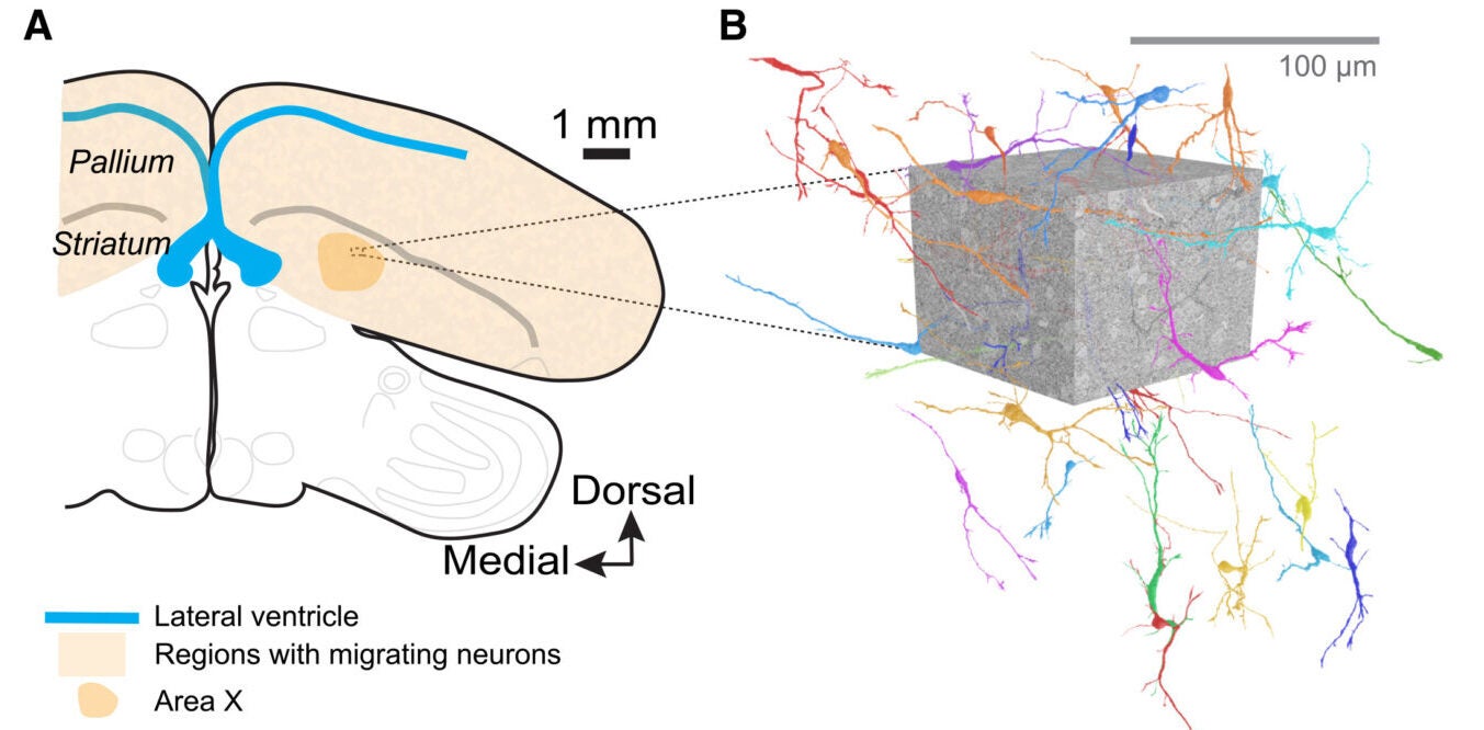 Overview of neuron migration in the adult zebra finch brain. Neurons are born in the ventricular wall (blue line) and migrate throughout the pallium and striatum (orange shading), including Area X (orange outline).