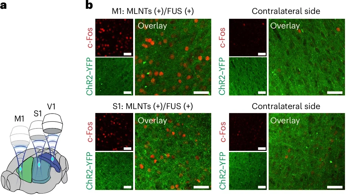 Validating the efficacy of the ultrasound-scanning light source that dynamically targets multiple brain regions.