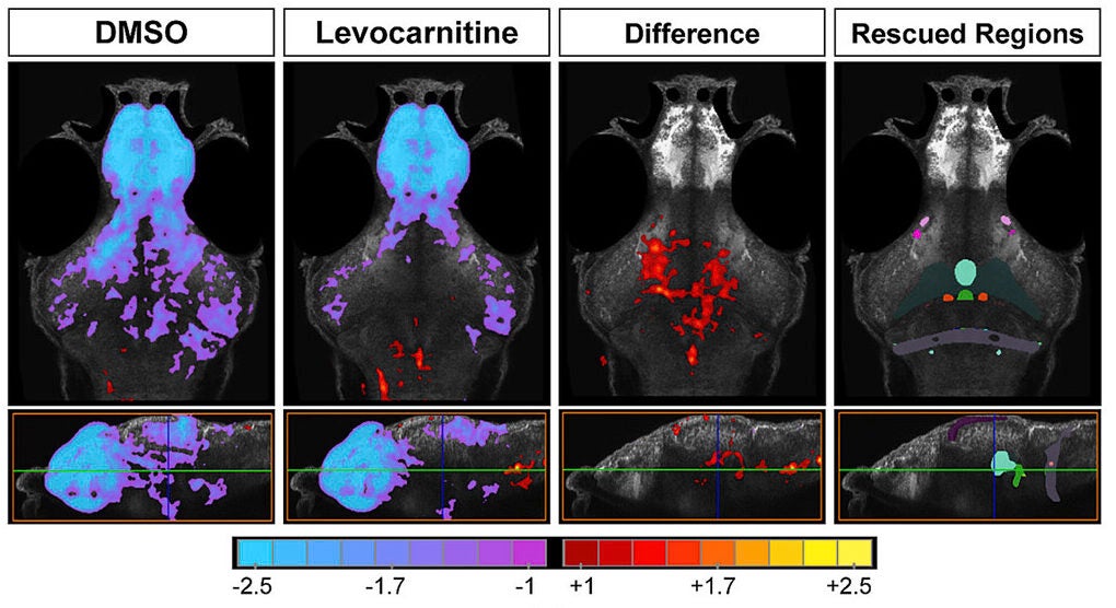 Voxel-wise Z score normalized pERK/tERK values representing brain activity differences in scn1labΔ44/Δ44 + DMSO or LEVO compared to DMSO-treated scn1lab+/+ larvae and the difference between the two conditions; the Right panel shows rescued regions from the 149-region atlas. Axial views, Top row; sagittal views, Bottom row.