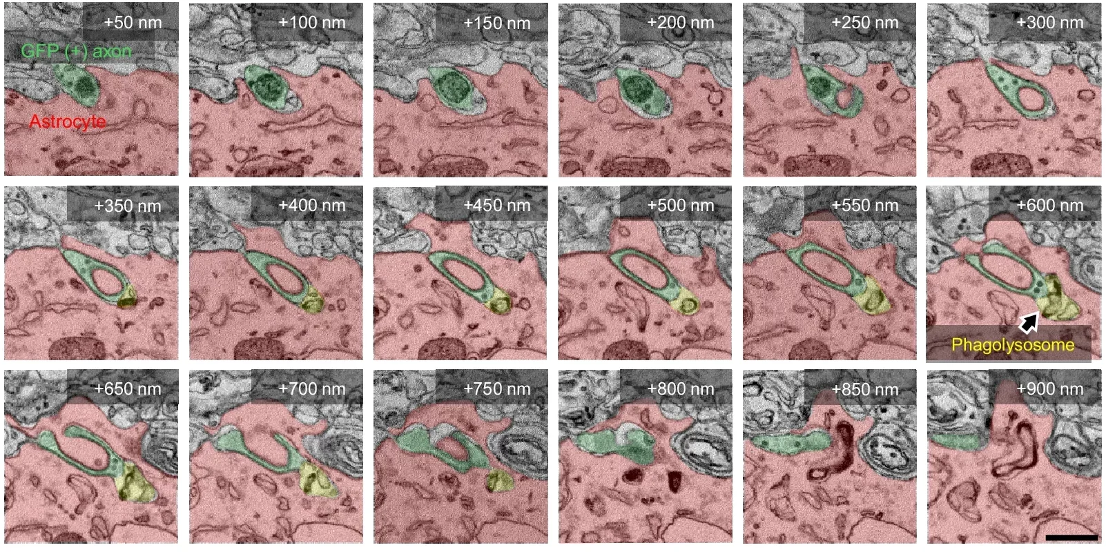 Serial EM images showing phagolysosome-like structures near SynTrogo-associated membrane configurations. 