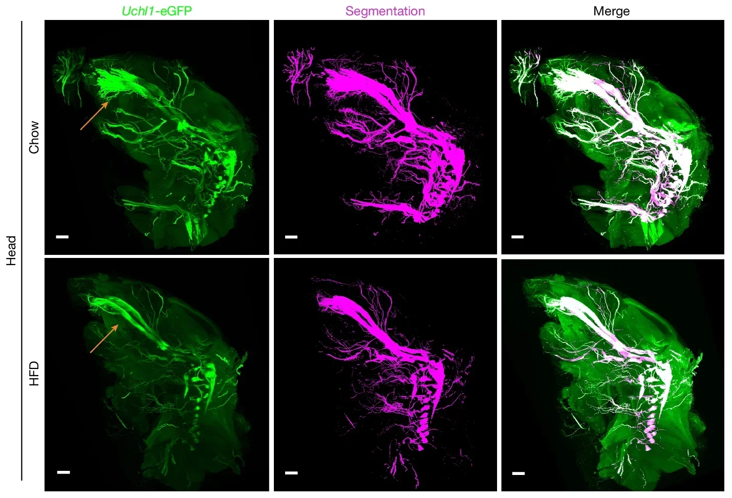 Representative heads of chow and HFD-fed mice showing Uchl1-eGFP+ nerves and AI-based segmentation of these nerves.