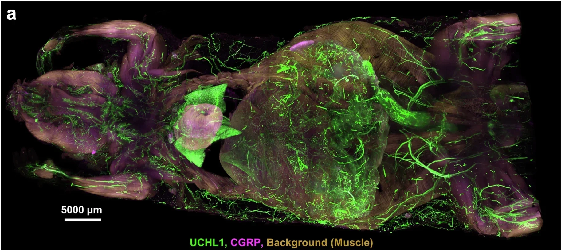 3D representation of ventral light-sheet fluorescence microscopy scan of a wildtype mouse (n=1) that was antibody labelled with the pan-nerve marker UCHL1 and a sensory nerve marker (CGRP).