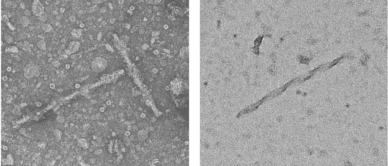Tau filaments formed after inhibition of a neuron's protein disposal machine, the neuroproteasome.