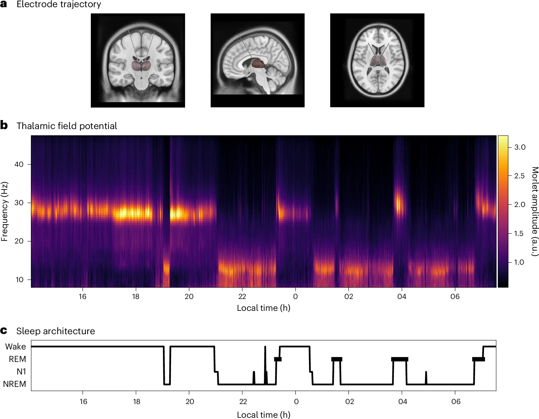 Example electrode trajectory and thalamic field potential recordings over extended time periods.