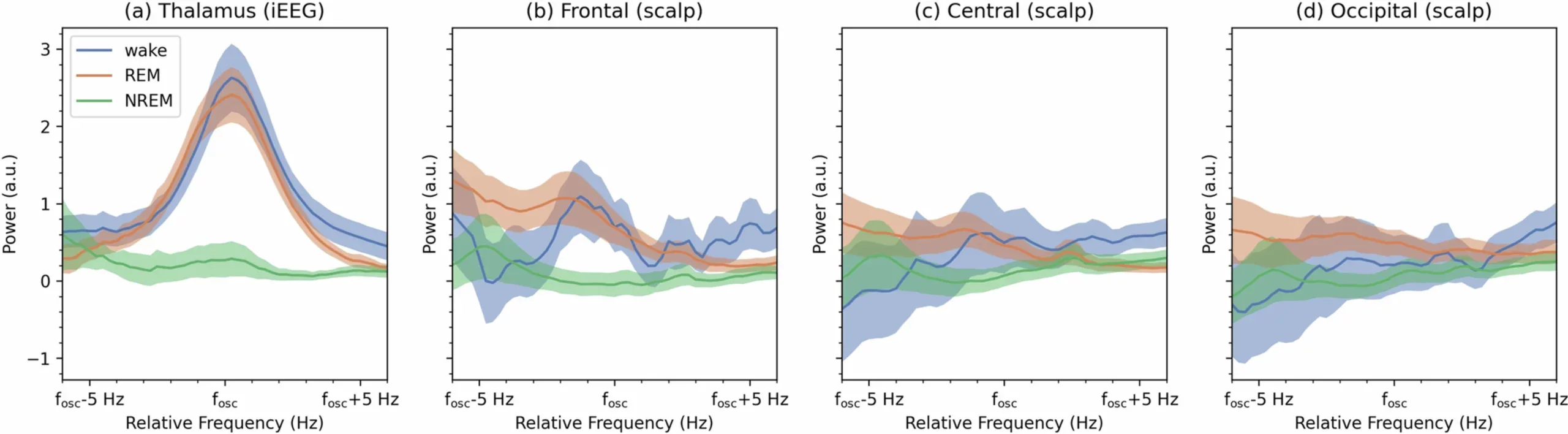 Aperiodic-subtracted Power Spectra for Wake- and REM sleep- specific oscillations (at 19-40 Hz).