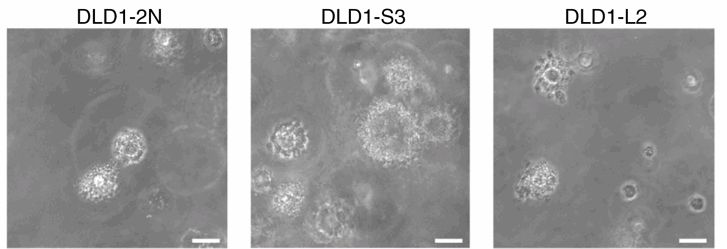 Representative images of soft agar colonies from DLD1 2N (left), S3 (middle), and L2 (right).
