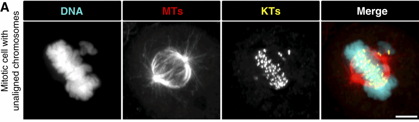 Representative image of a mitotic cell with a distinct metaphase plate and unaligned chromosomes near one of the spindle poles.