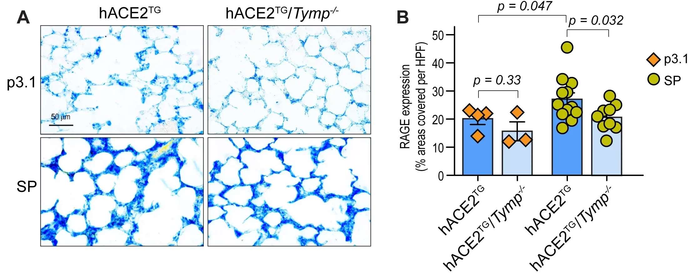 SARS-CoV-2 spike protein (SP) induces lung injury, inflammatory cell infiltration, microthrombus formation, and ACE2 shedding.