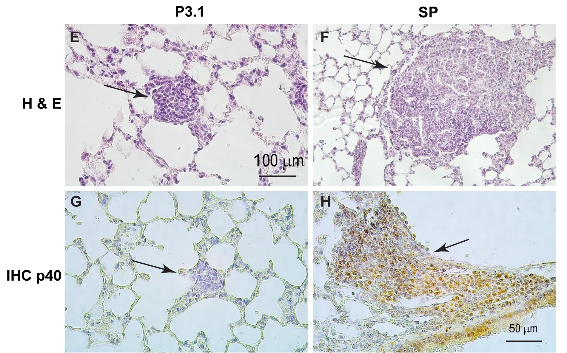 (E, F) Hematoxylin & Eosin staining with representative histological images of lung tumors. (G, H) Immunohistochemical staining for p40, a marker of lung squamous cell carcinoma.