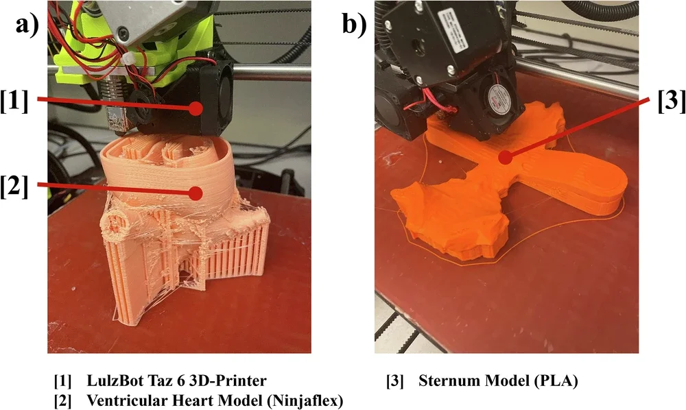 3D-printing of anatomical models.