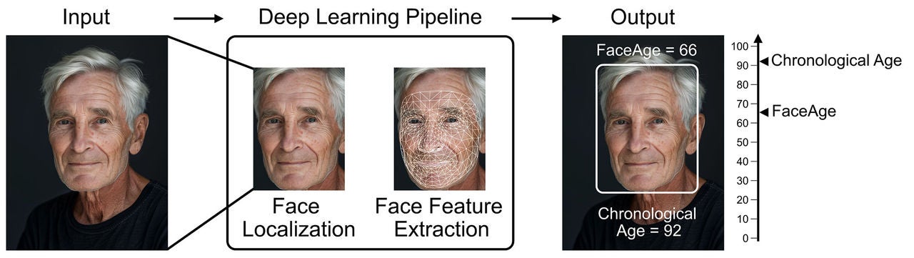The FaceAge algorithm uses a single photograph of the face as input. First, a convolutional neural network localises the face within the photograph. Next, a second convolutional neural network quantifies face features and uses these to predict the FaceAge of the person.