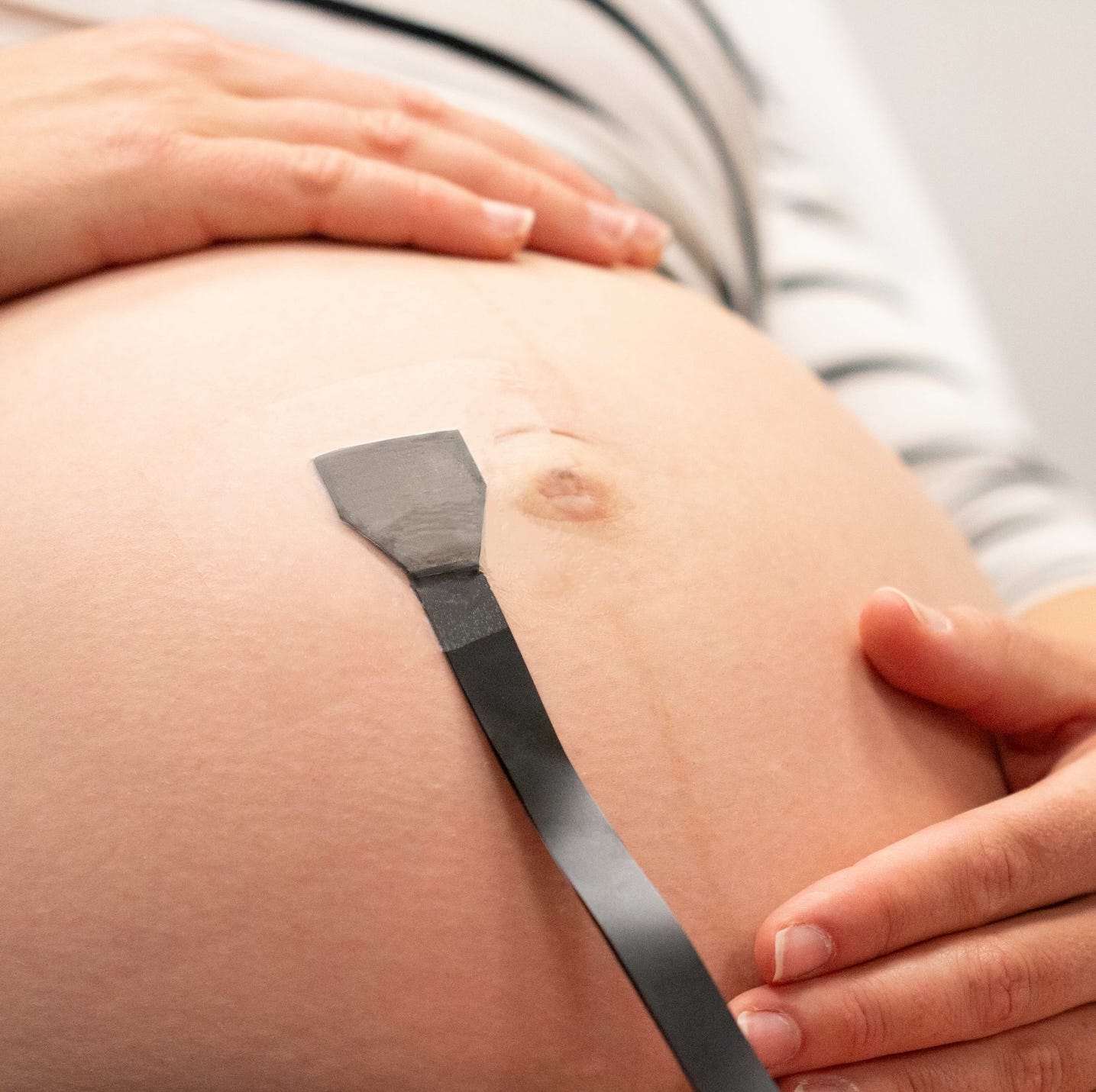 Researchers developed a wearable ultrasound patch that continuously monitors fetal blood flow and may improve care for high-risk pregnancies.