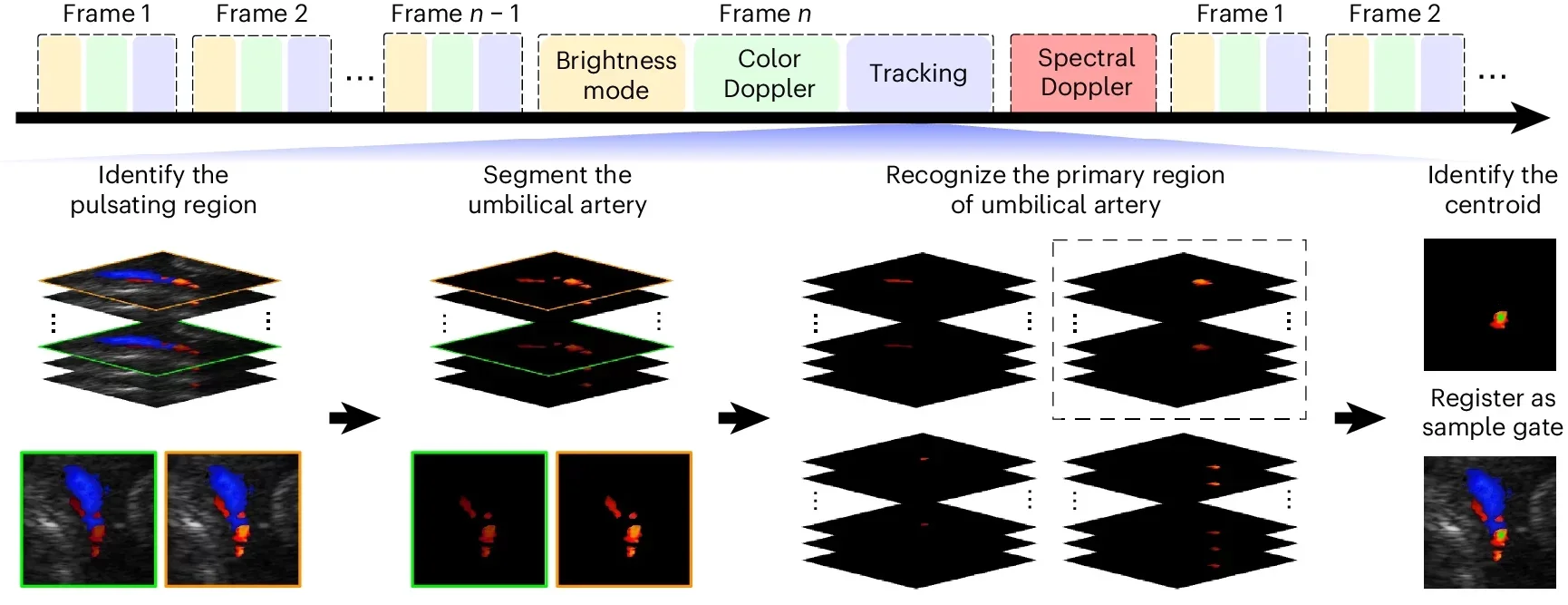 Autonomous vessel tracking by image segmentation.