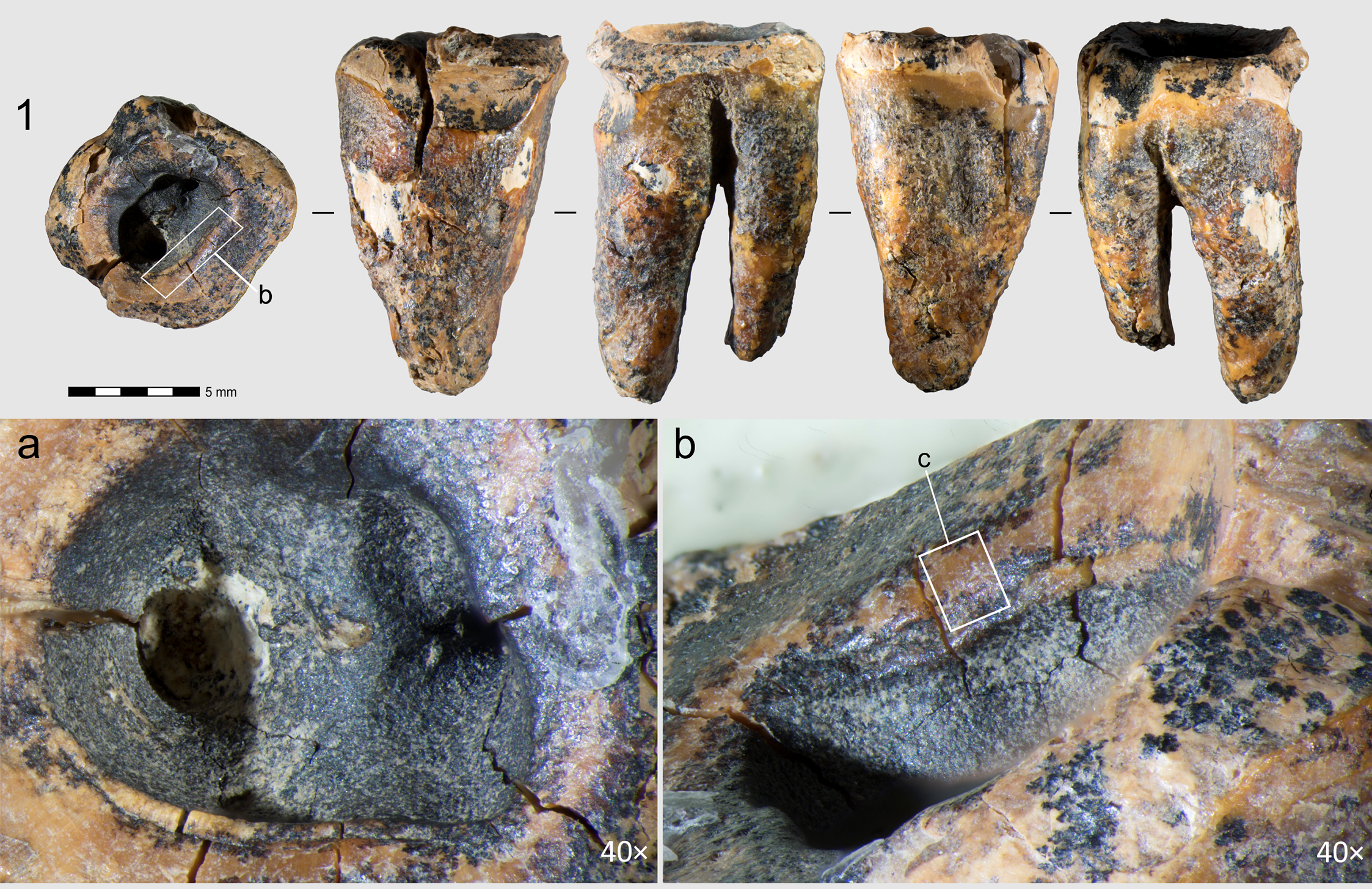 Chagyrskaya 64 molar tooth and its macro-features.