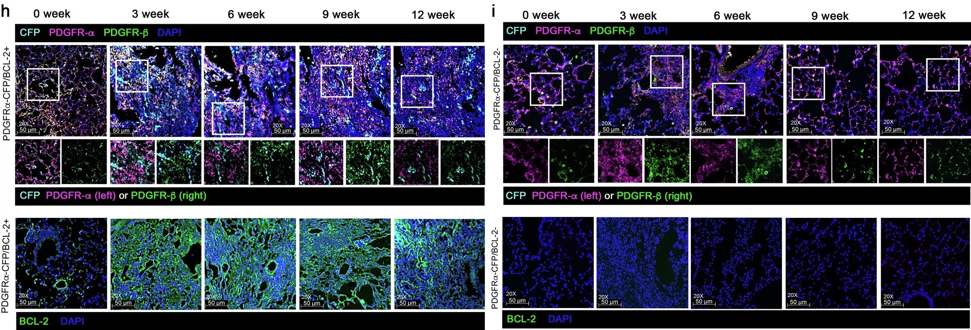Conditional expression of BCL-2 in PDGFRα+ fibroblasts results in their persistence after fibrosis induction.