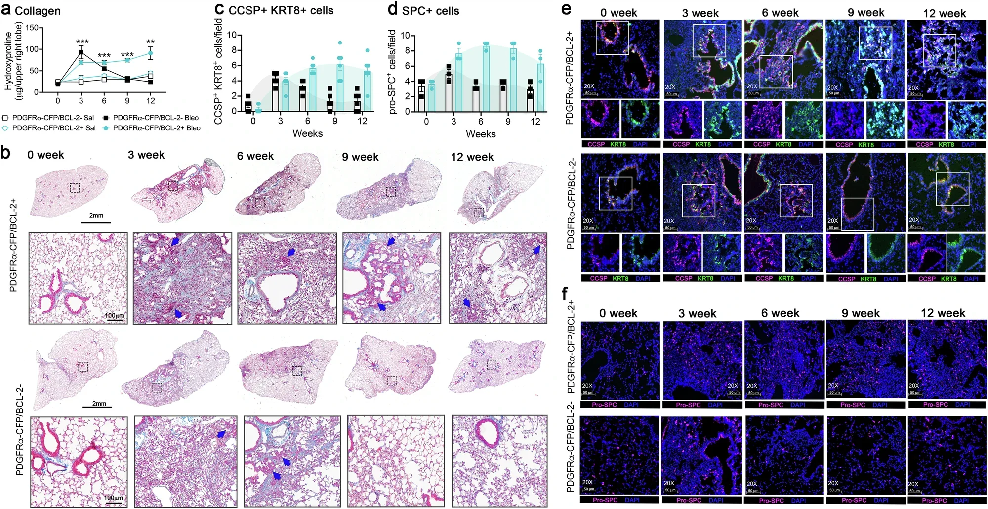 Conditional expression of BCL-2 results in persistent fibrosis after bleomycin.