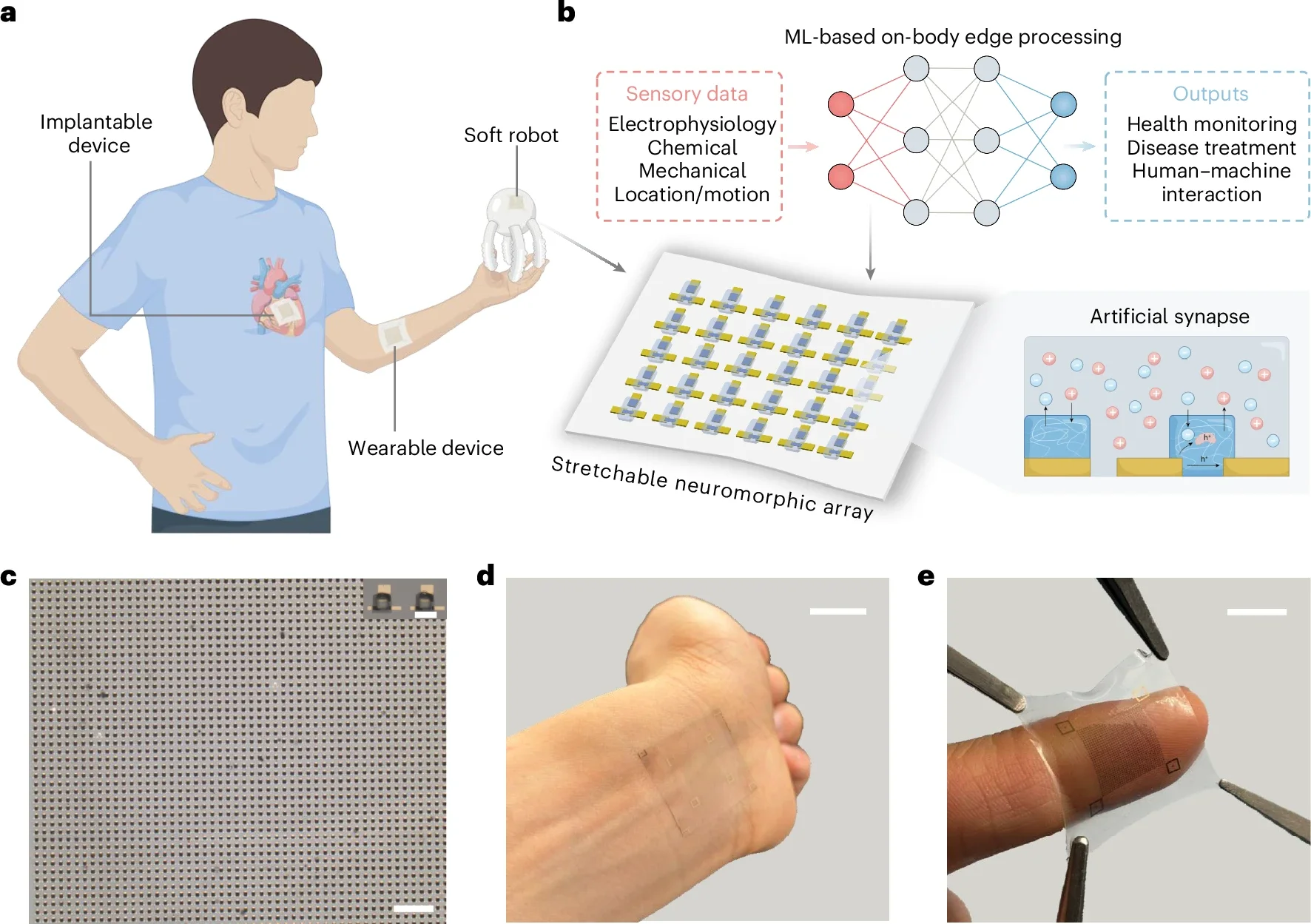 Large-scale intrinsically stretchable neuromorphic array for on-body edge computing.