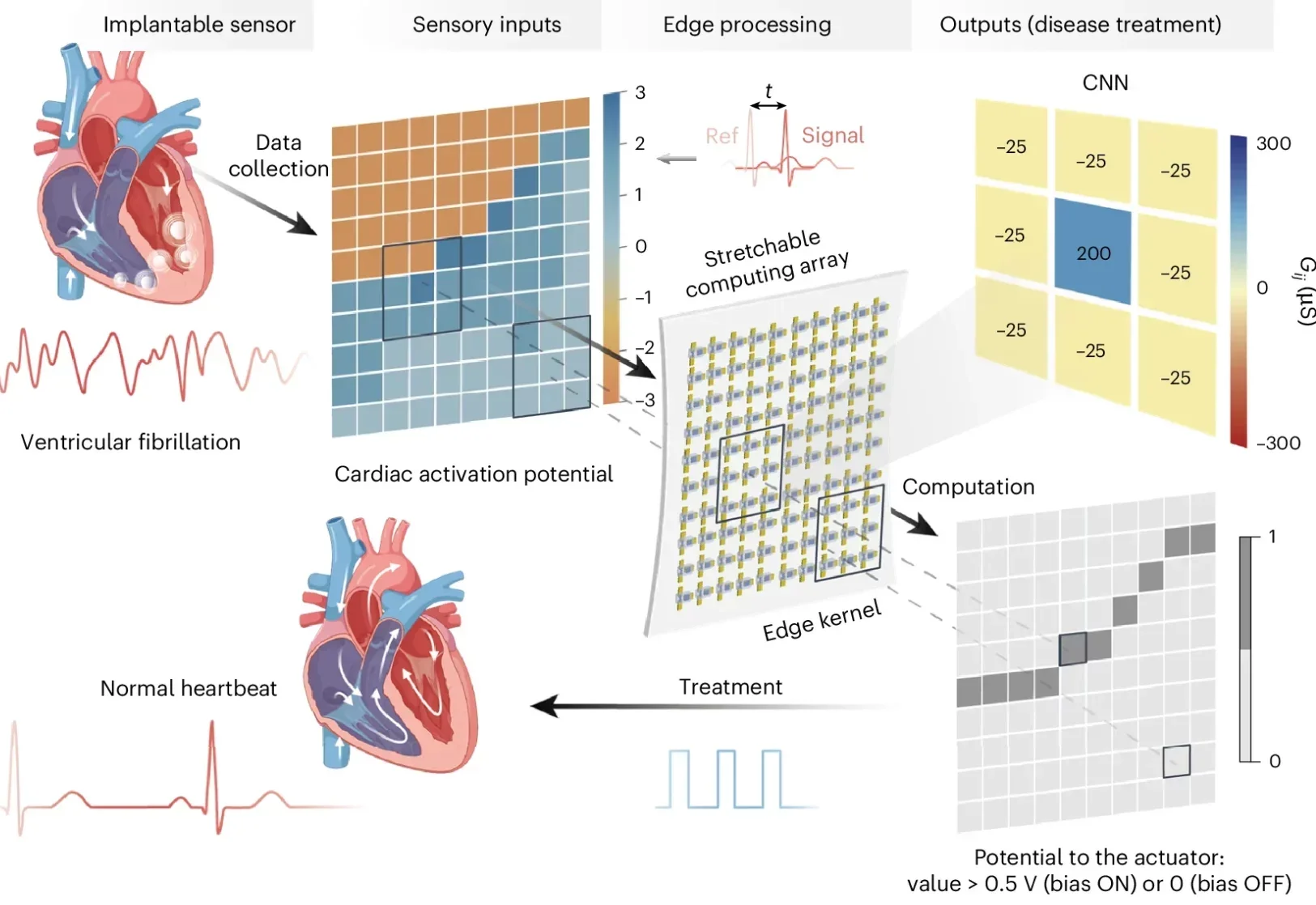 Workflow for cardiac activation wavefront detection using our stretchable neuromorphic array, which serves as an edge detection kernel that performs convolution operations on cardiac data, facilitating precise arrhythmia monitoring and treatment.