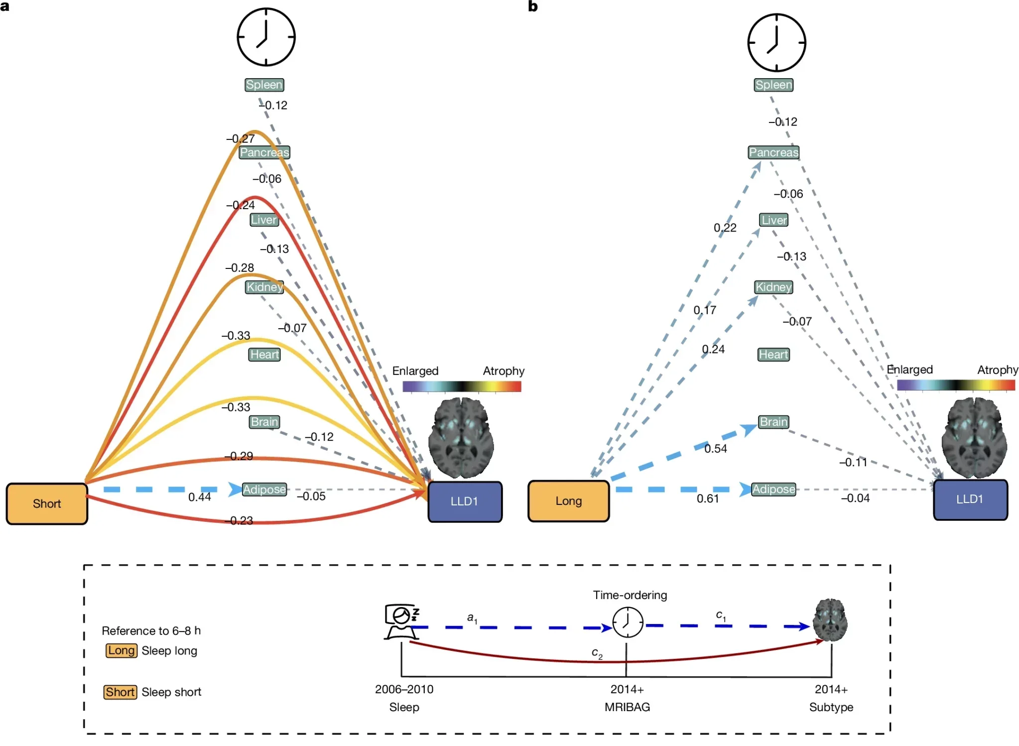 Seven MRIBAGs mediate the effects of disturbed sleep duration patterns on two LLD subtypes.
