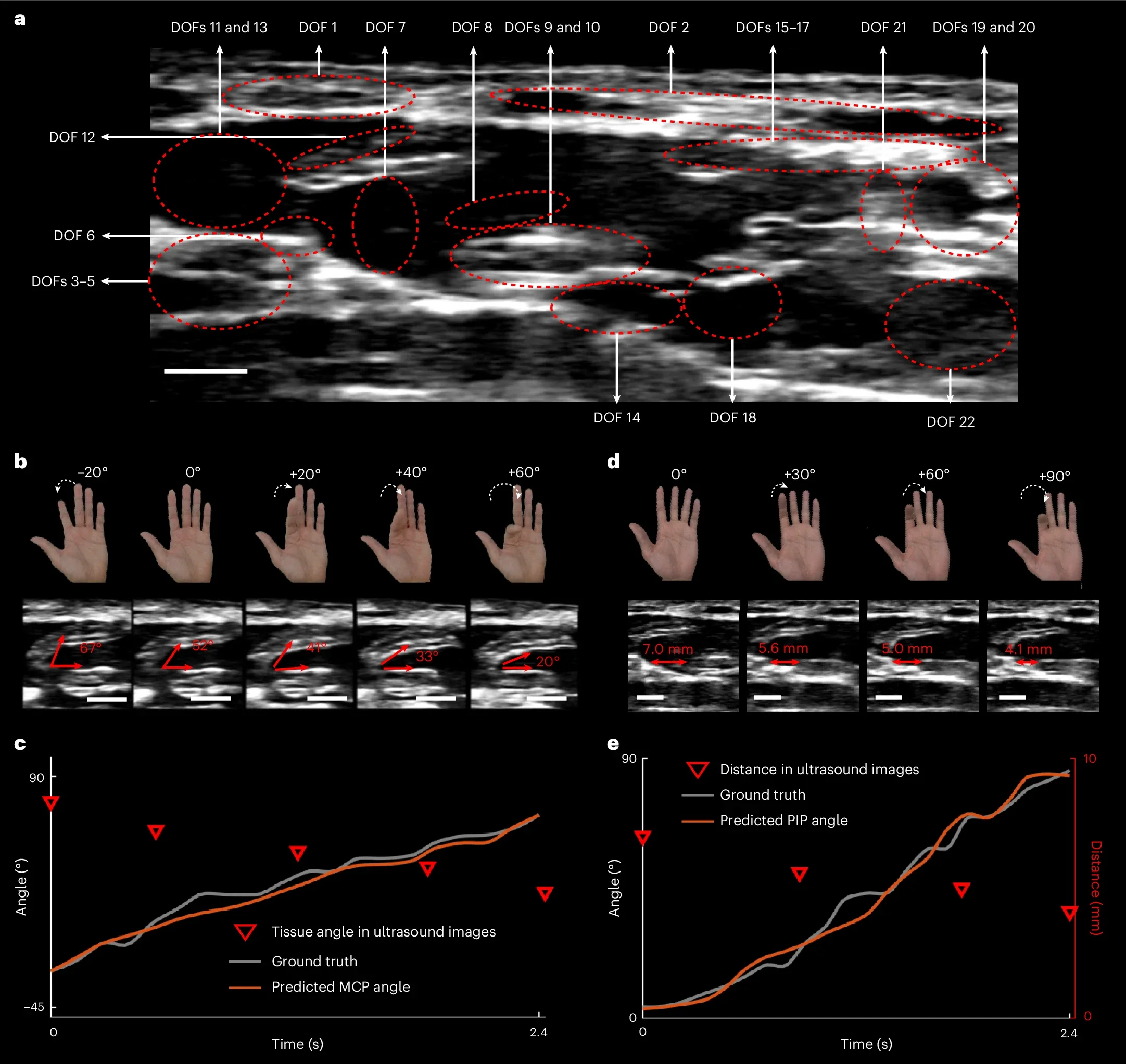 Principle of dexterous hand tracking via wearable full-wrist imaging.