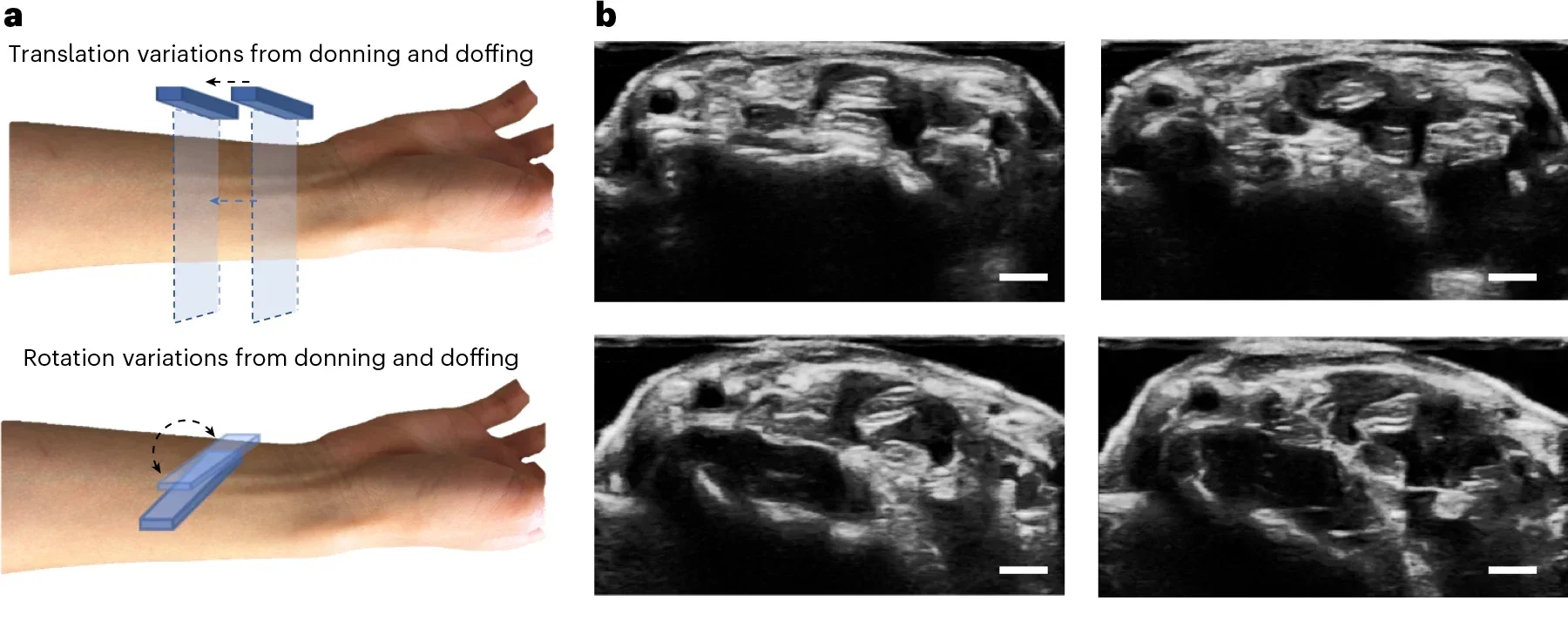 Performances of wearing-position-robust hand tracking.