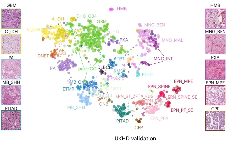 Neighborhood embedding of slide representations. Slide-level embeddings from the internal validation set are visualized in two dimensions using UMAP (number of neighbors = 5, minimum distance = 0.5).