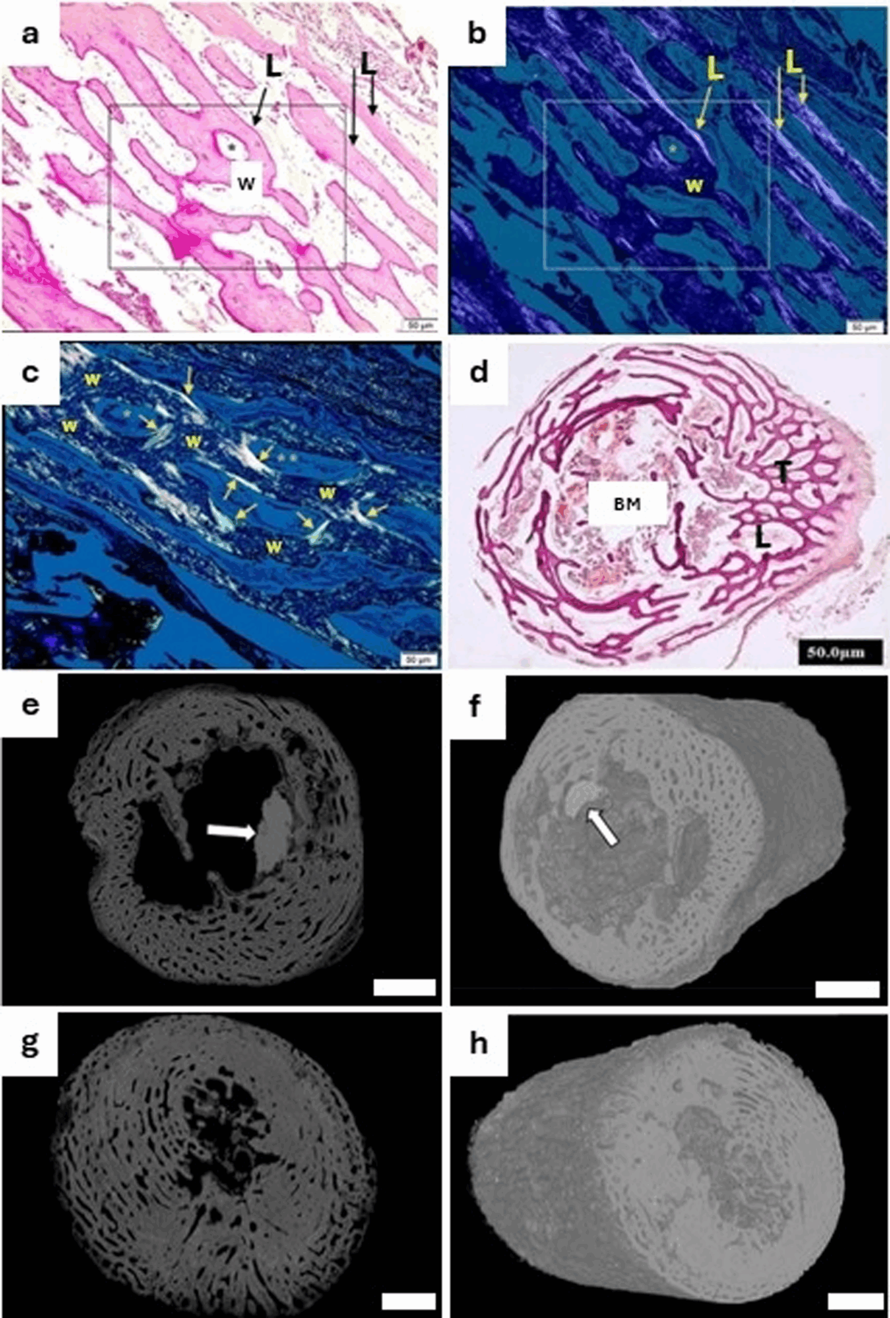Histology (a–d) and micro-CT (e–h) images showing modern human bone microstructure in long bone shafts from second and third trimester stages of development. 