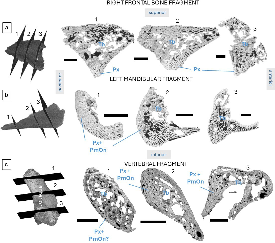 Bone microanatomy in Sesselfelsgrotte 1 visualized in three slices per bone fragment: right frontal bone fragment (a), left mandibular fragment (b), and vertebral fragment (c, most likely anterior view).