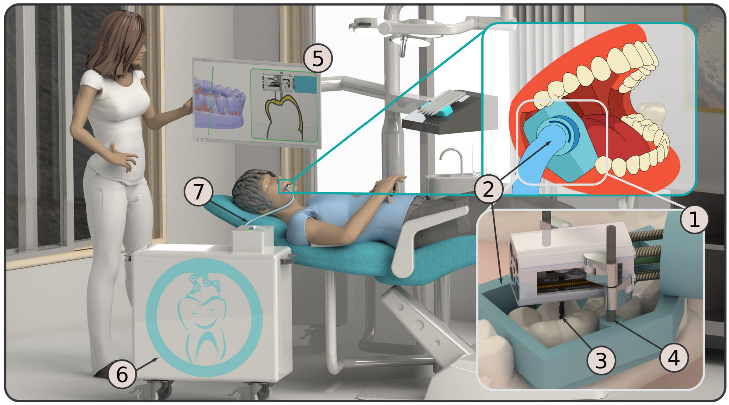 Initial idea of the miniature intraoral robot. The tooth preparation is carried out by the miniature intraoral robot (MIR)