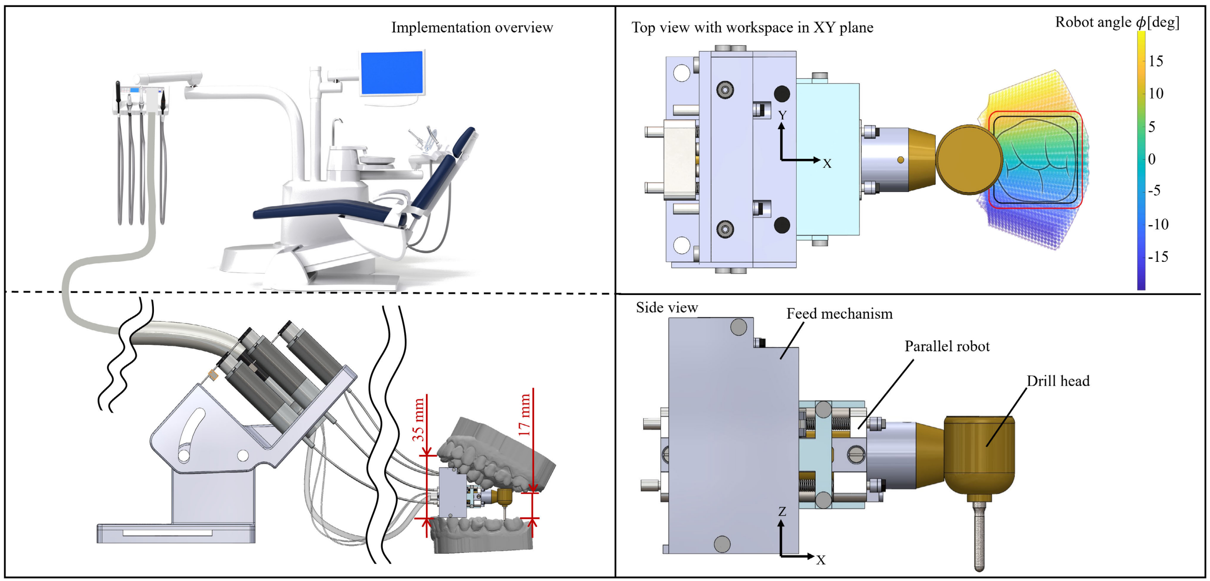 The overview of the MIR’s design and connection with a dental chair. The MIR consisted of a feed mechanism allowing for the sliding frame, which holds the parallel robot with the drill head moving in the vertical direction.
