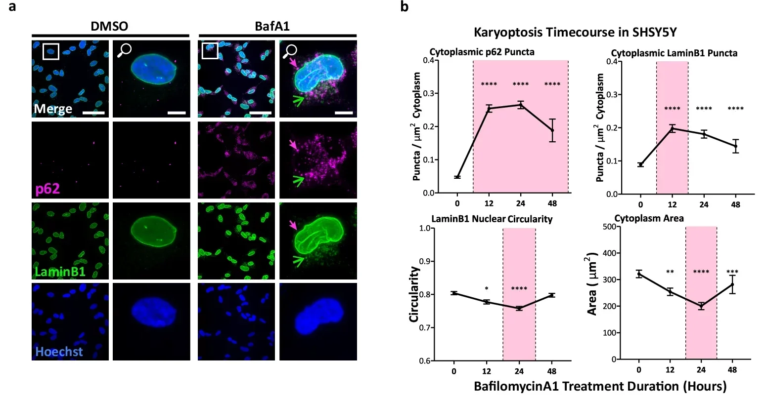Impairment of autophagic clearance triggers loss of nuclear degeneration and expulsion and cell death.