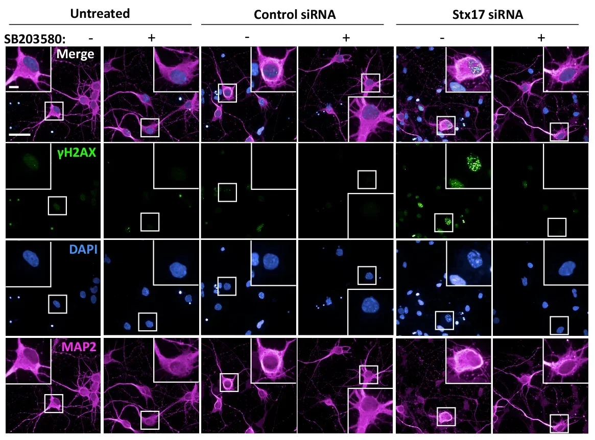  Images of γH2AX, DAPI and MAP2 immunofluorescence in rat primary cortical neurons treated with either control siRNA or Syntaxin17 siRNA for 72 h.