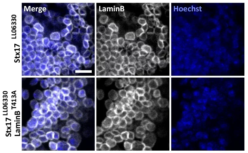 Mutations impairing LaminB1 phosphorylation by p38 MAPK increases protein stability and rescue karyoptosis phenotypes.