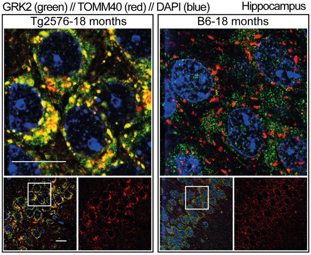 Immunofluorescence of GRK2 (green) and mitochondrial TOMM40 (red) in the CA1 hippocampal area of 18-month-old Tg2576 (left) and B6 (right) mice.