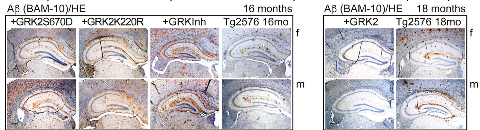 Hippocampal Aβ plaques (brown) of 16-month-old Tg2576-GRK2S670D, Tg2576-GRK2K220R, Tg2576-GRKInh, and Tg2576 (Tg2576 16mo) mice and 18-month-old Tg2576-GRK2 and Tg2576 (Tg2576 18mo) female and male mice.