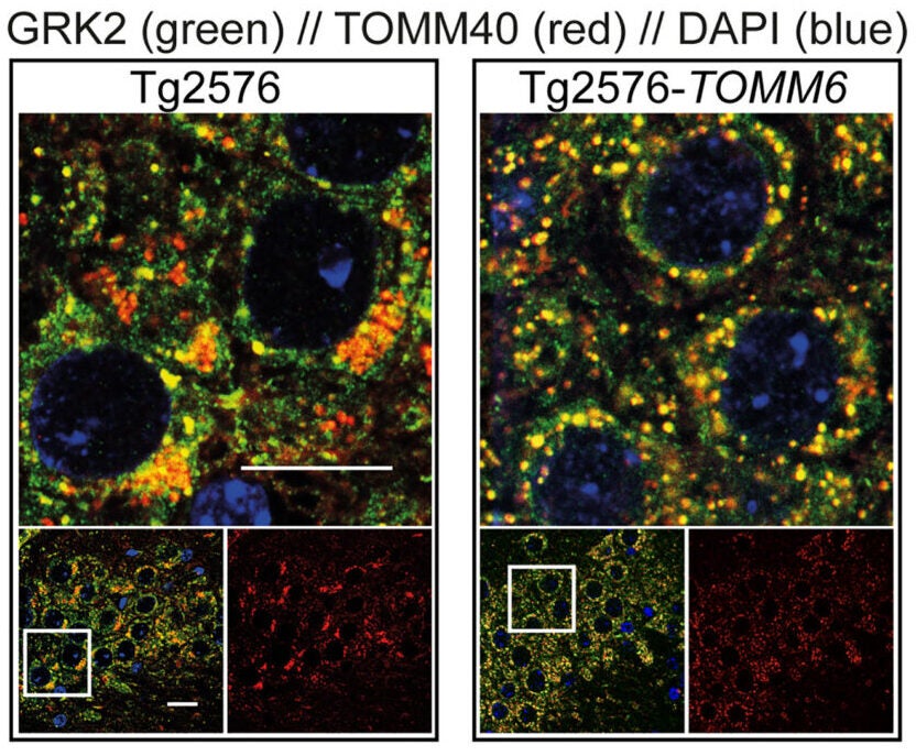 Immunofluorescence of GRK2 (green) and TOMM40 (red) in the hippocampal CA1 area of 18-month-old Tg2576 (left) and Tg2576-TOMM6 (right) mice.