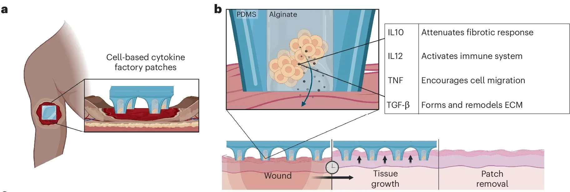 A patch for localized delivery of cytokines to a wound bed.