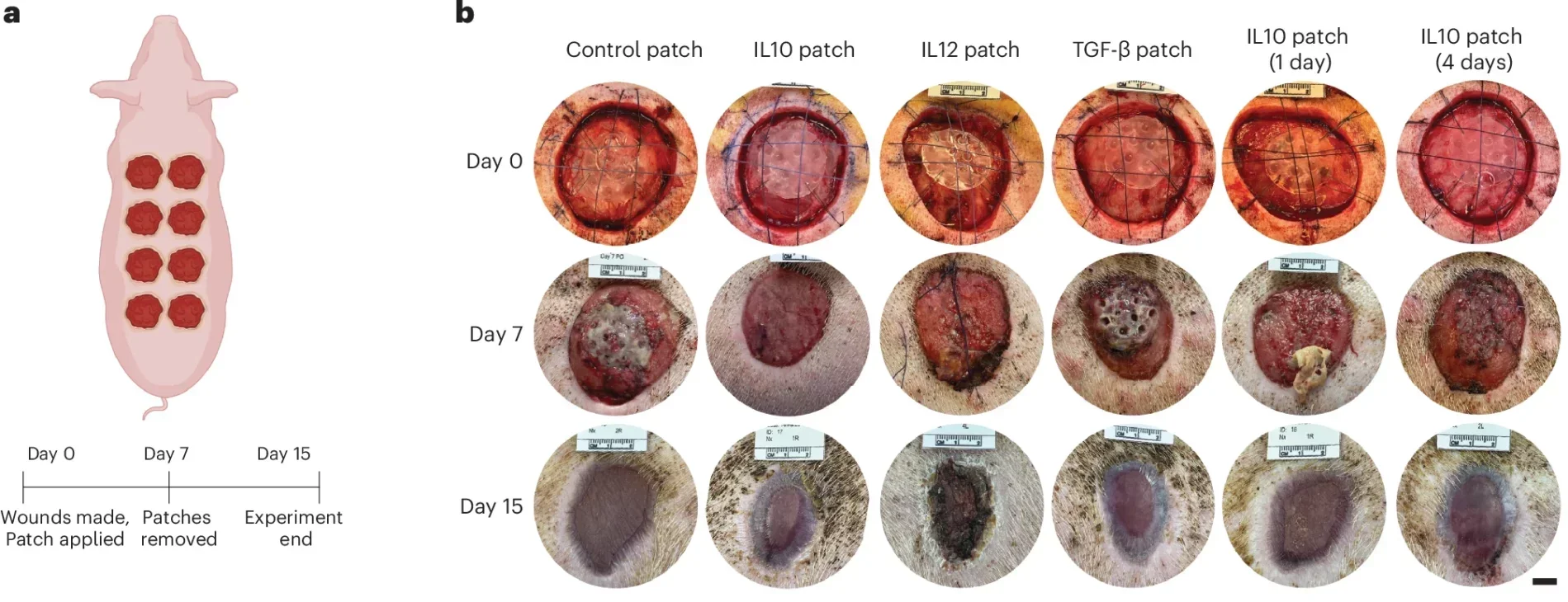 IL10, IL12 and TGF-β delivered from the patch accelerates wound healing in a porcine wound model.