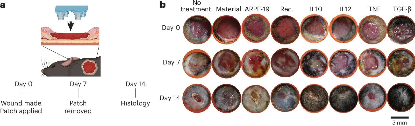 IL10, IL12 and TGF-β delivered from the patch accelerates wound healing in a murine wound model.