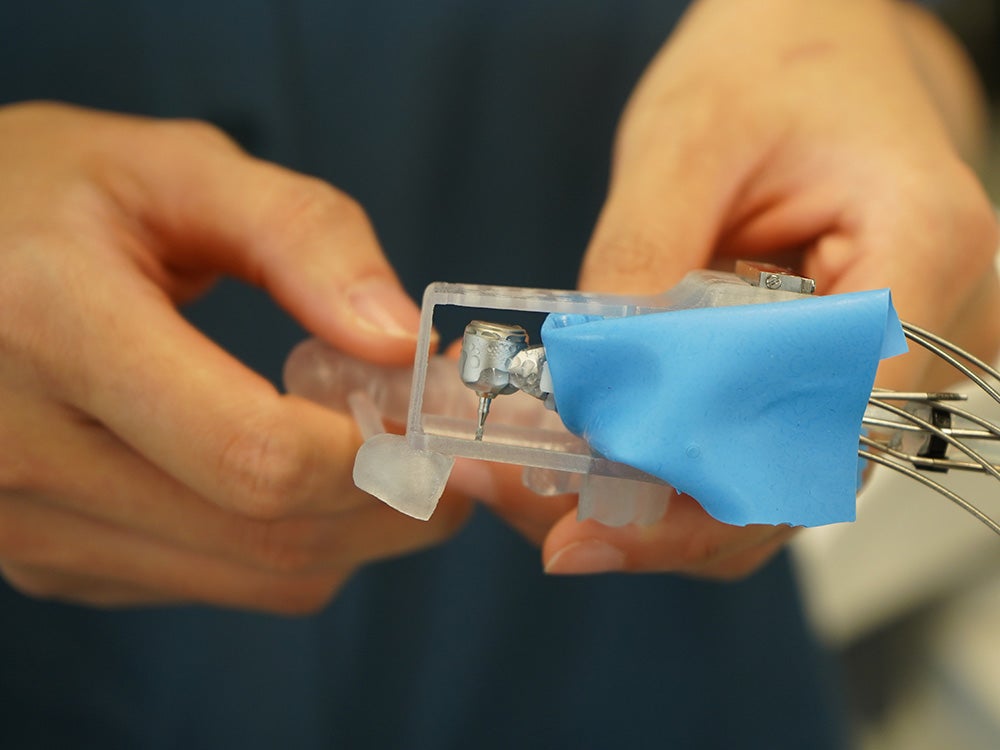 The dental robot is mounted on a custom-fitted dental splint. Even if the patient moves their head, the robot can keep working precisely where it ought to.