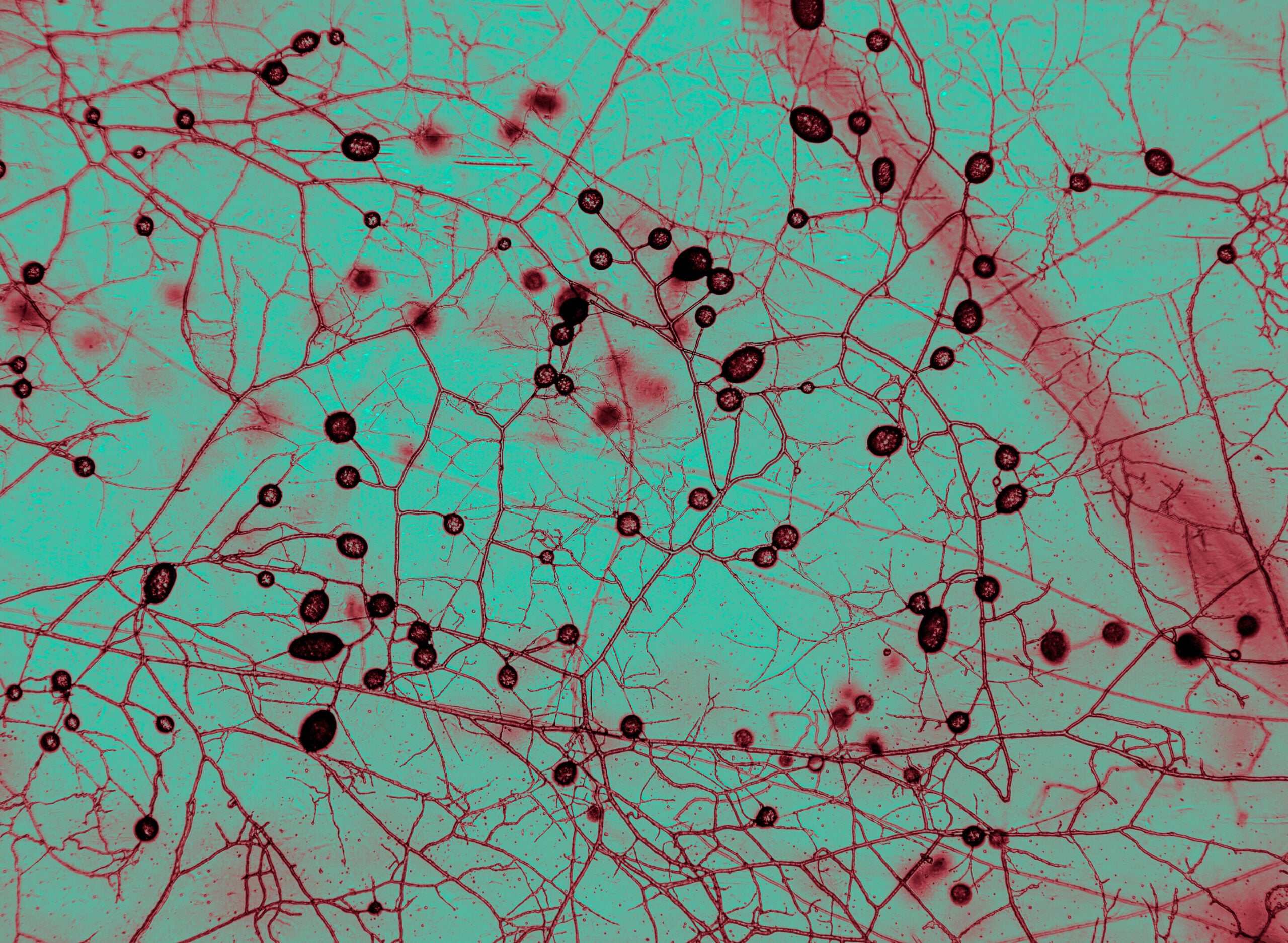 Mycorrizhal fungi under the microscope at AMOLF biophysics institute in Amsterdam. The circular structures are spores. Color is altered for legibility.