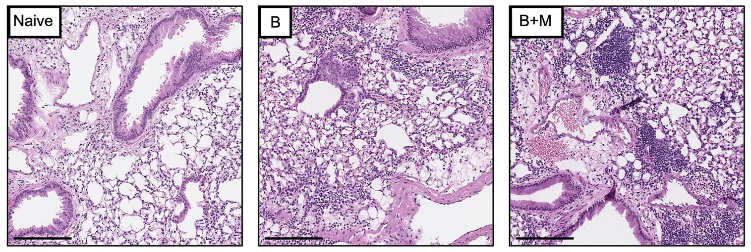 Representative hematoxylin and eosin-stained sections of challenged airways of wild-type mice. 