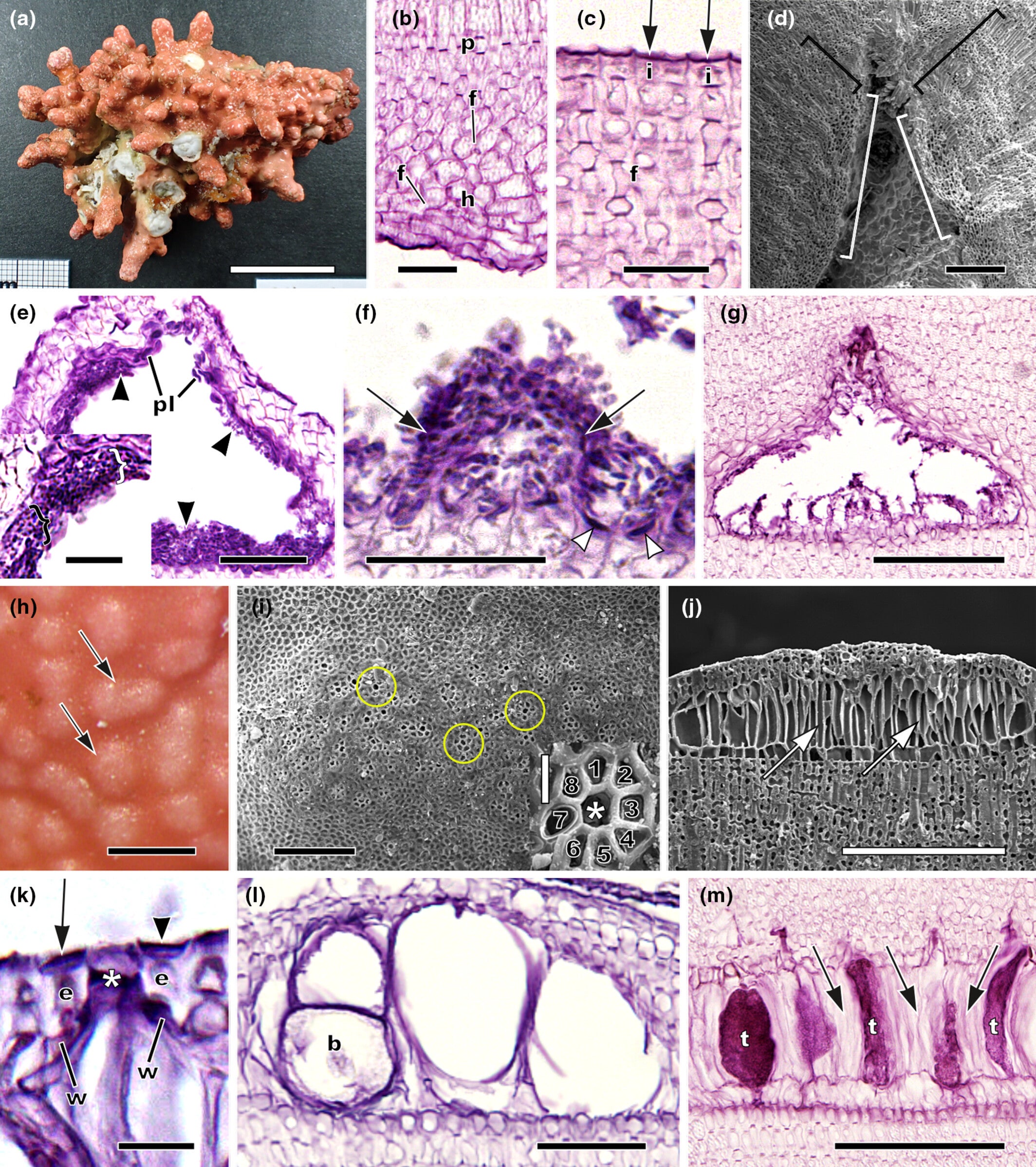 Habit, vegetative, and reproductive characters of Roseolithon sparsituberculatum sp. nov.