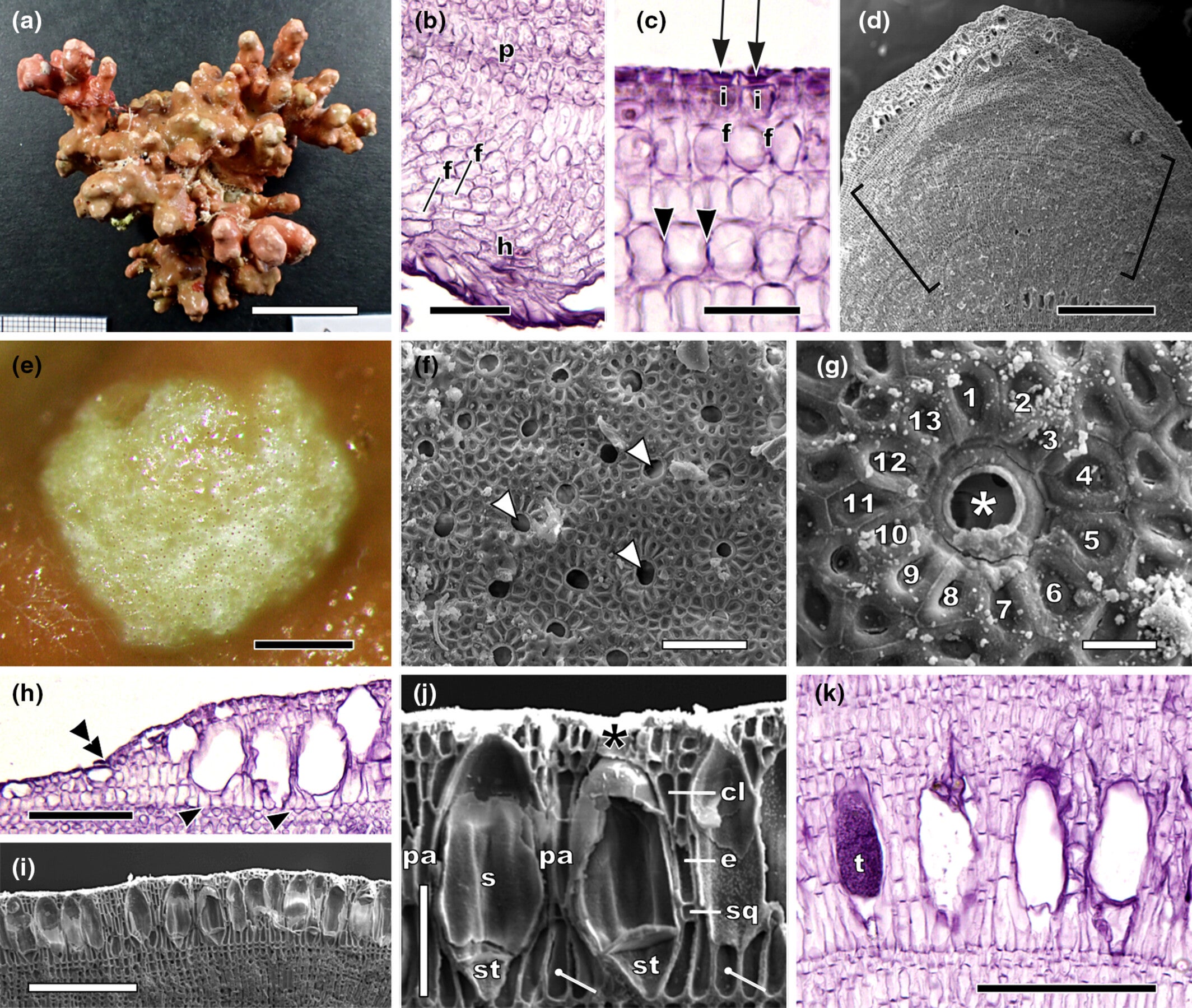 Habit, vegetative, and reproductive characters of Sporolithon variotuberculatum sp. nov.
