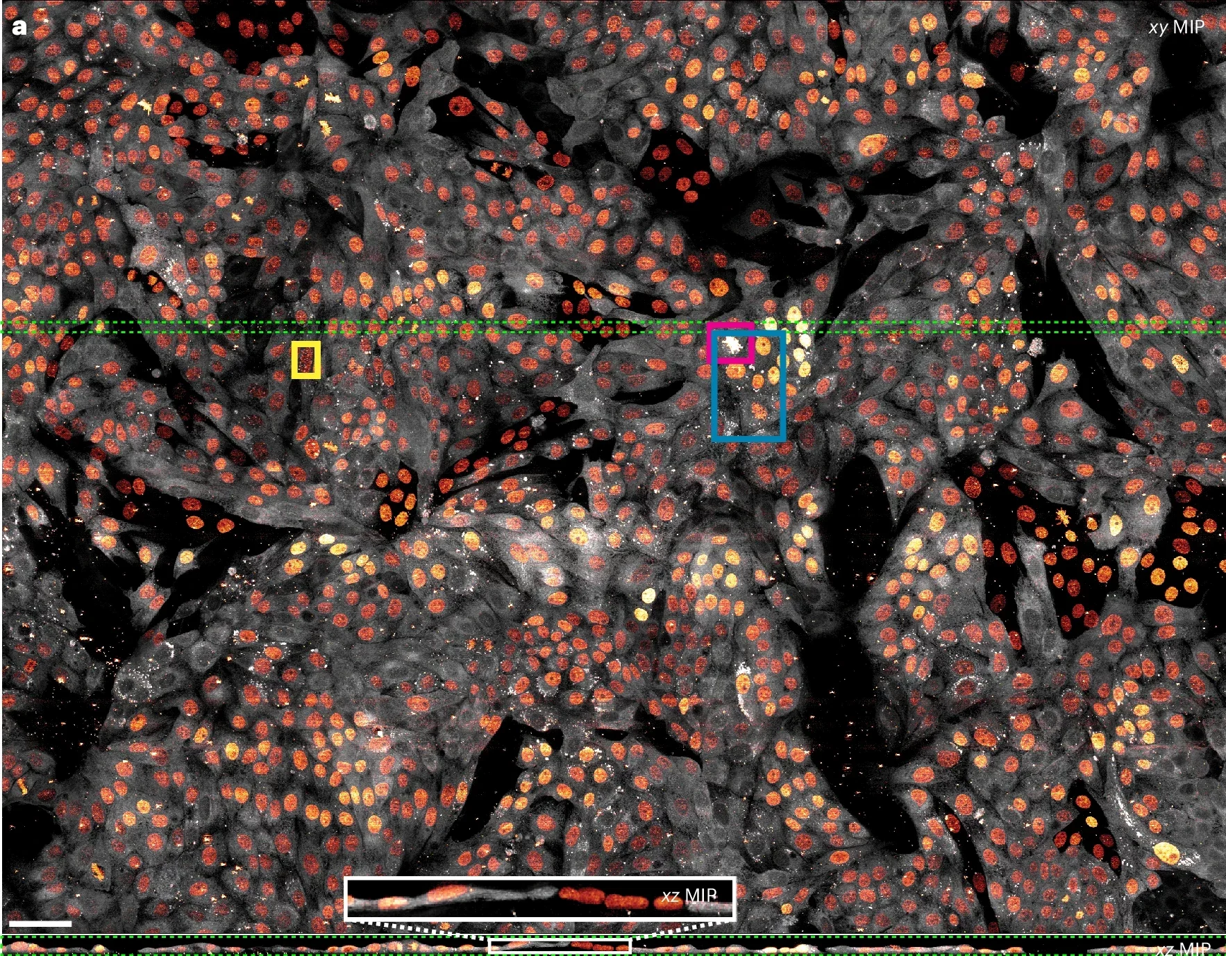 Large field-of-view dynamic imaging with 3D lattice light-sheet or 2D label-free oblique illumination microscopy.