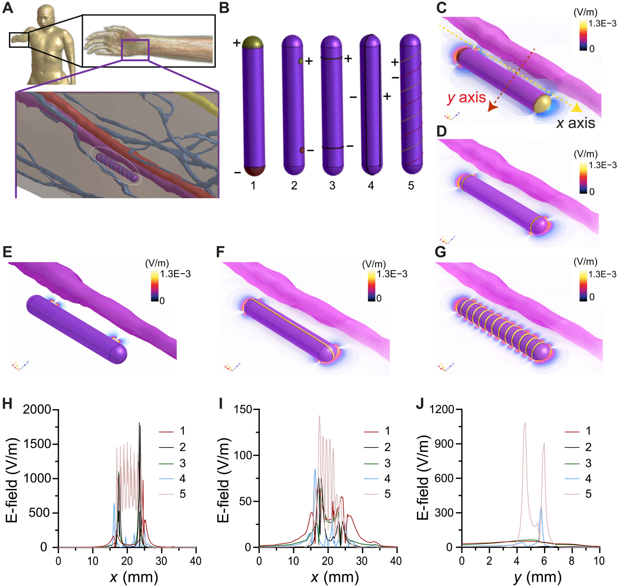 Human-scale electric-field modeling of SEED electrode topologies in an anatomical forearm model.